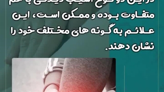 تفاوت پیچ خوردگی مچ پا و شکستگی آن