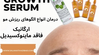 بهترین روش درمان ریزش مو