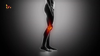 بهترین ویتامین و ۵ میوه برای ترمیم رباط ها و تاندون ها