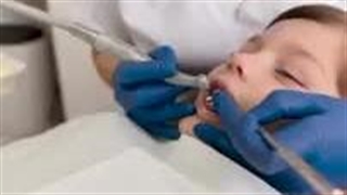 فیشورسیلانت برای کودکان