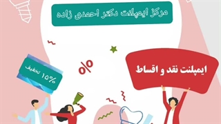 ایمپلنت دیجیتال