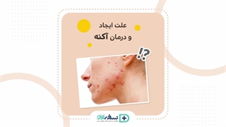 علت ایجاد و درمان آکنه - داروخانه آنلاین نسخه اول - داروخانه اینترنتی نسخه اول