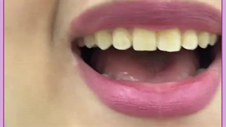 تجریش دندان29