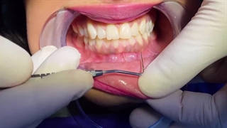 نکات مهم در سلامت لثه (کلینیک دندانپزشکی شبانه روزی دریا )