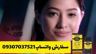 چاقی صورت هات ویتا 09307037521