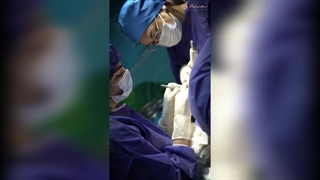 شرایط کاشت مو اقساطی مشهد در کلینیک سلامت ایده آل