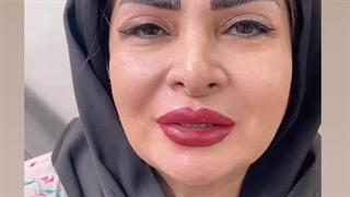 مرکز تخصصی ابرو چشم لب