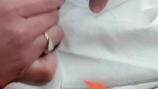 ببینید پرستار انگشترِ تنگو با چه مهارتی در آورد.