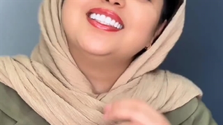 رضایت از انجام کامپوزیت مشهد در کلینیک دندانپزشکی بارانا