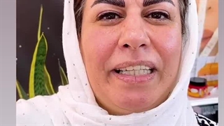 مرکز تخصصی ابرو چشم لب