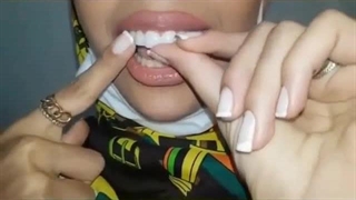 لمینت متحرک دندان را از کجا بخریم ؟