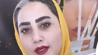 مرکز تخصصی ابرو چشم لب