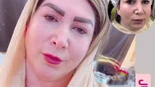 مرکز تخصصی ابرو چشم لب