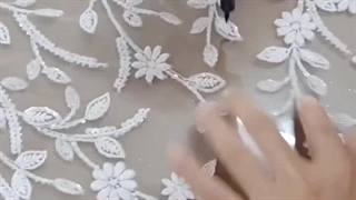 خرازی فرهاد کشیدن دندان