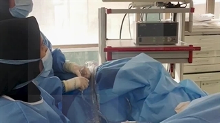 هیستروسکوپی پولیپکتومی