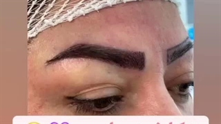 کاشت ابرو دائمی در کلینیک آرتین