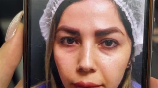 جراحی پلک و لیفت لب در کلینیک آرتین