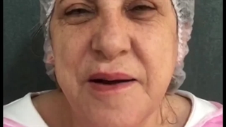 عمل جراحی بفاروپلاستی توسط دکتر خوانساری