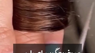 رفع موخوره به روش صحیح مالالیز