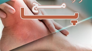 آرتریت مچ پا