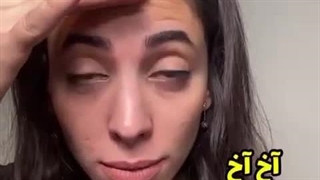 سرم بوتاکس گاتیو