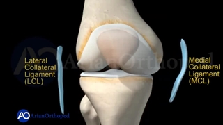جراحی آرتروسکوپی رباط صلیبی قدامی(ACL)