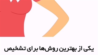 ام آر ماموگرافی یا ام آر آی سینه