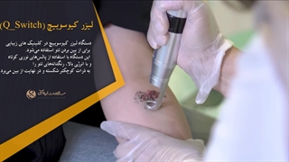 انواع دستگاه‌ها در کلینیک سلامت ایده آل مشهد