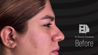 جراحی همزمان فک و چانه در کلینیک دکتر هوشنگی