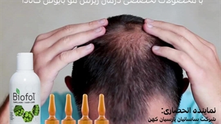 بهترین روش درمان ریزش مو و رشد مجدد موها