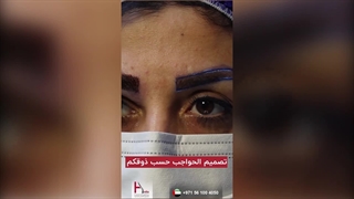 زراعة الحواجب بالنتائج الدائمة والمضمونة فی عیادة هیلیا