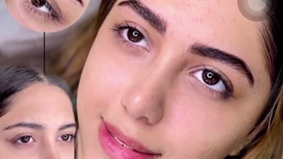 مرکز تخصصی ابرو چشم لب