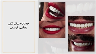 خدمات دندانپزشکی زیبایی و ترمیمی