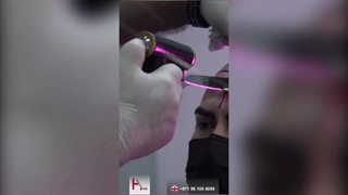 The Best Hair Transplant Clinic in Dubai with Permanent Results