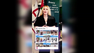 Hair and Eyebrow Transplantation using the Micrograft Method in Dubai