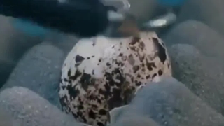 دقت ربات های جراح!!!