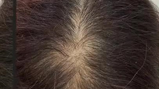 میکرواسکالپ سر آکادمی فی کانادا