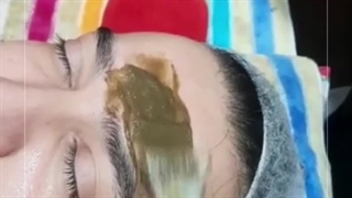 فیشیال پوست صورت در کرج ترمیم سوختگی