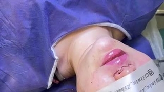 لب روسی در کلینیک آرتین