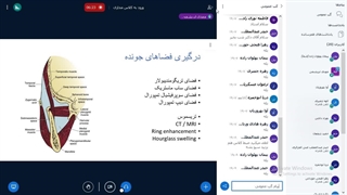 جراحی نظری 2 - دکتر حسن زاده - جلسه 2 برداشتن زگیل