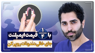 با یک چهارم قیمت ایمپلنت جای خالی دندونات رو پر کن