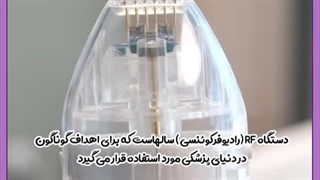 آر اف فرکشنال کشیدن دندان