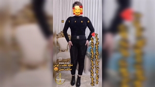 عمل ابدومینوپلاستی و تزریق چربی به باسن در مشهد عصب‌کشی