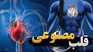 ساخت قلب مصنوعی از آهن ربا و تیتانیوم