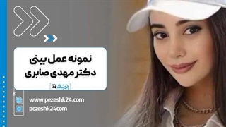 دکتر مهدی صابری بهترین جراح بینی در تهران ترمیم زیبایی دندان