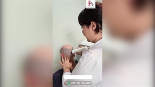 نعید لکم شعرکم بضمان _ زراعة الشعر الدائمة والطبیعیة