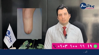 بهترین زمان برای دریافت پای مصنوعی | پروتز ساز