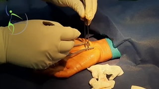 درمان گزگز انگشتان دست توسط جراح ارتوپد کلینیک درد مهرگان