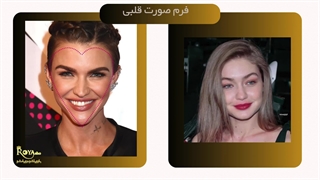 انواع فرم صورت