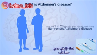 آلزایمر